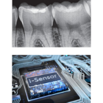 Woodpecker Sensore Rvg I-Sensor H1 - immagine 3