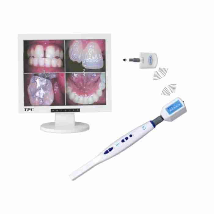 TPC Advanced Kit Monitor + Telecamera Intraorale + Braccio - immagine 1