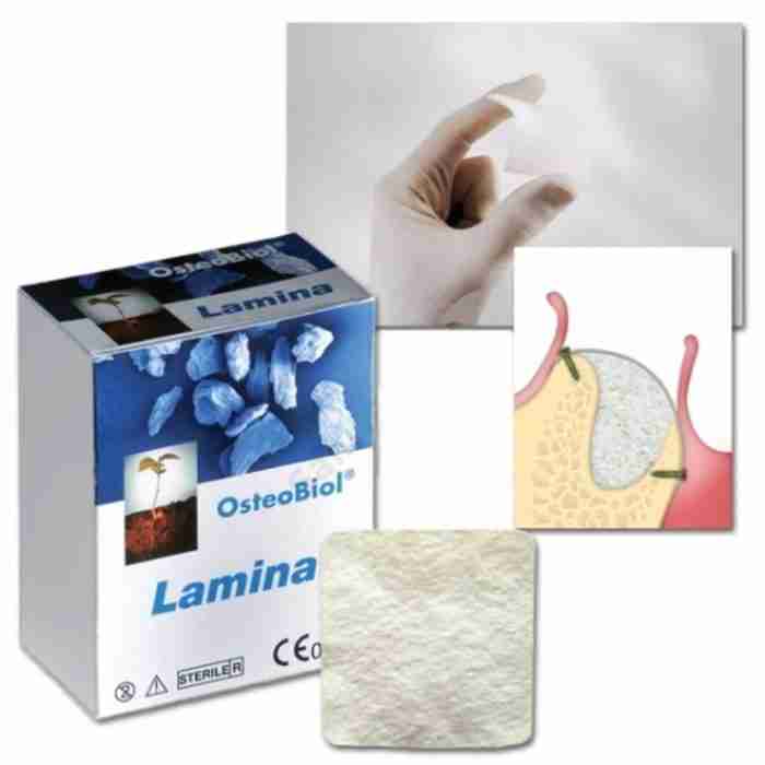Tecnoss Osteobiol Lamina Corticale Sf Essiccata 25x25mm - immagine 1