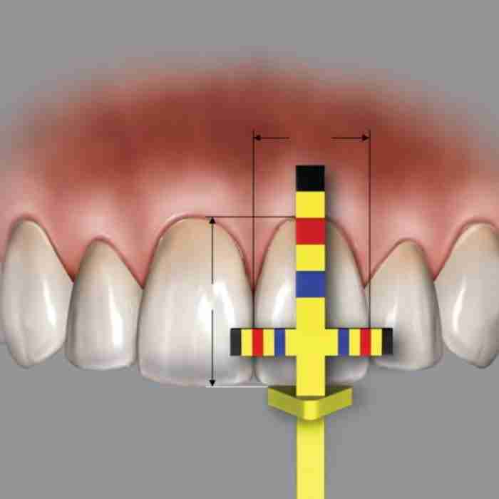 Hu-Friedy Strumento Chu Per Misurazione Proporzioni - immagine 1