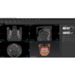 Imprevo Impronta Digitale (Scanner) - immagine 7